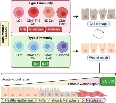 Autoimmunity as an Etiological Factor of Cancer: The Transformative Potential of Chronic Type 2 Inflammation